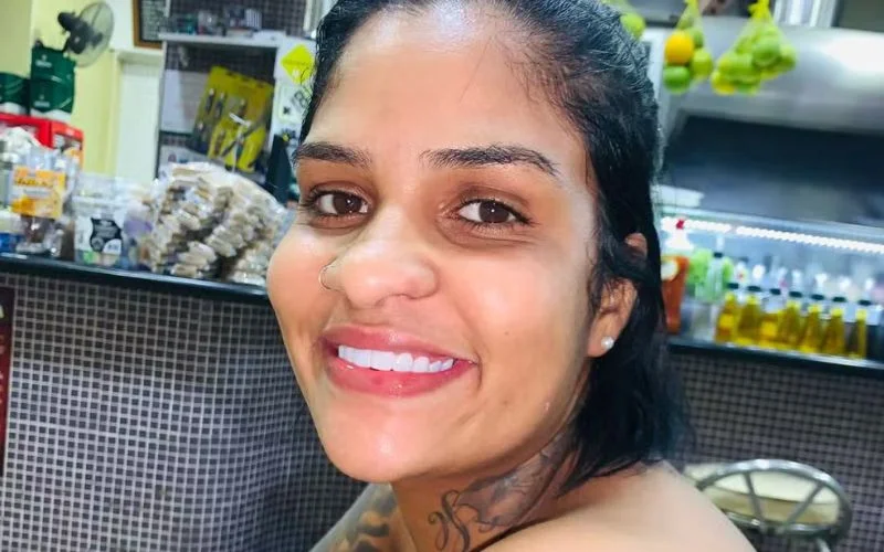 Vai ser muito doloroso : Mulher atropelada por carro ainda não sabe que teve pernas amputadas abc+