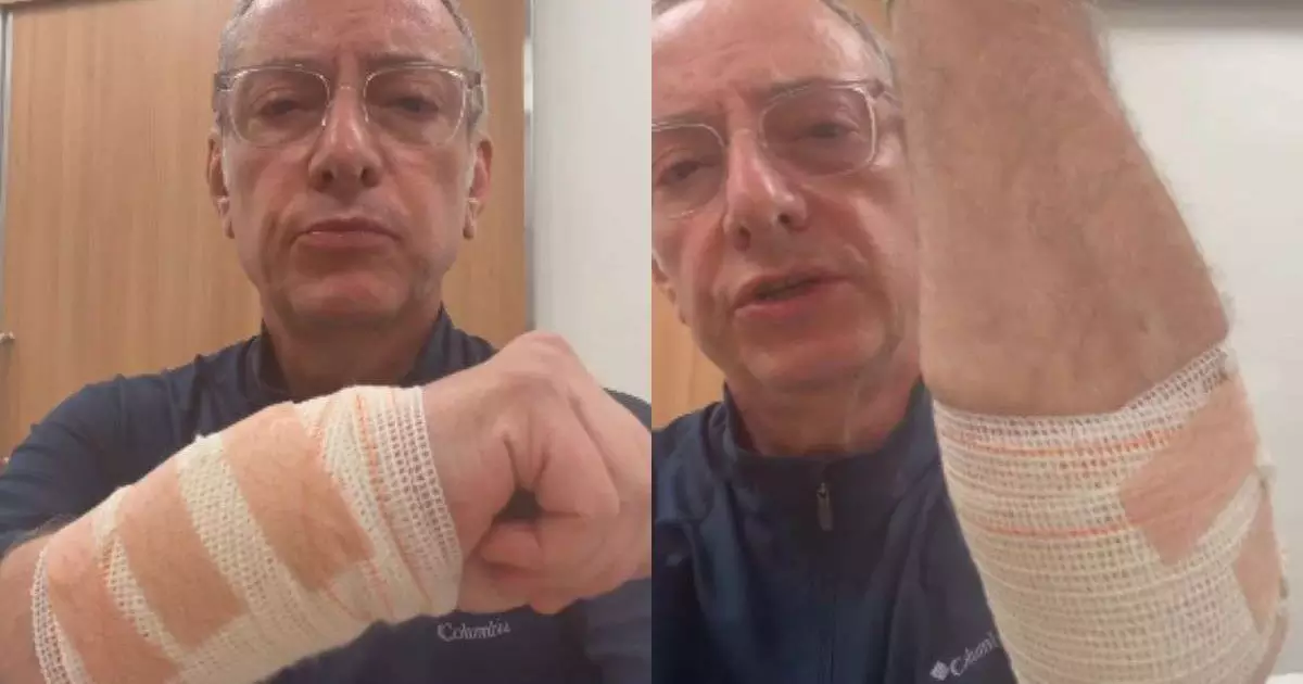 Jornalista da Globo fica gravemente ferido após ataque de pitbull veja como ele está