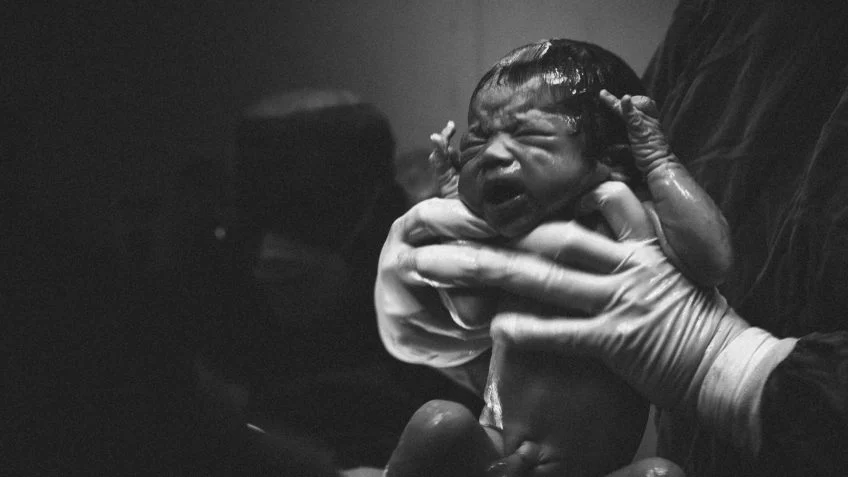 Cresce número de cesáreas no SUS mesmo em gestações de baixo risco