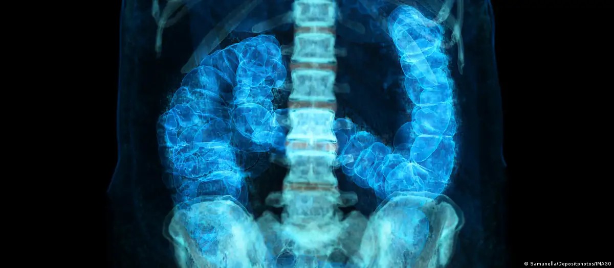 Câncer no intestino: maioria desconhece exame preventivo, diz pesquisa G1
