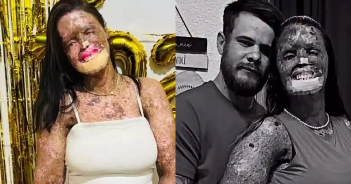 LUTO Influenciadora morre aos 31 anos após batalha contra doença rara