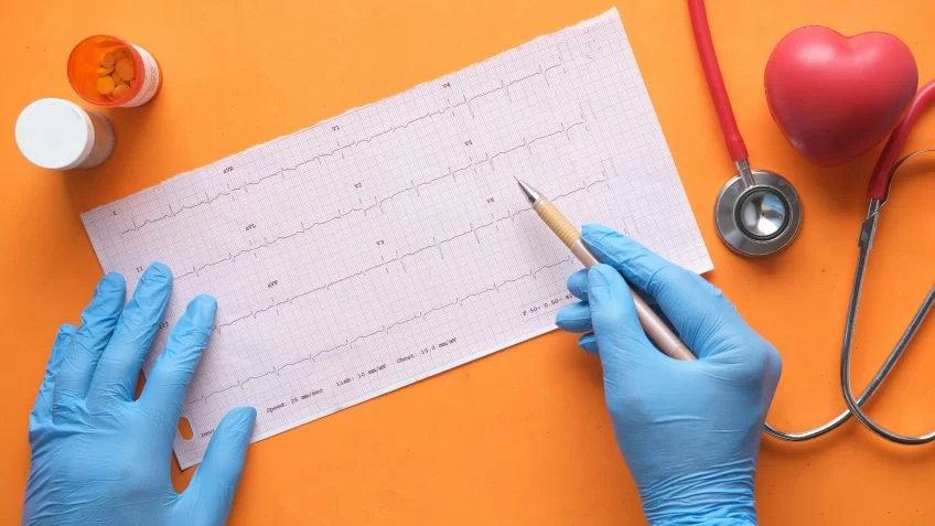 A vida após o infarto: cuidados não acabam depois do stent