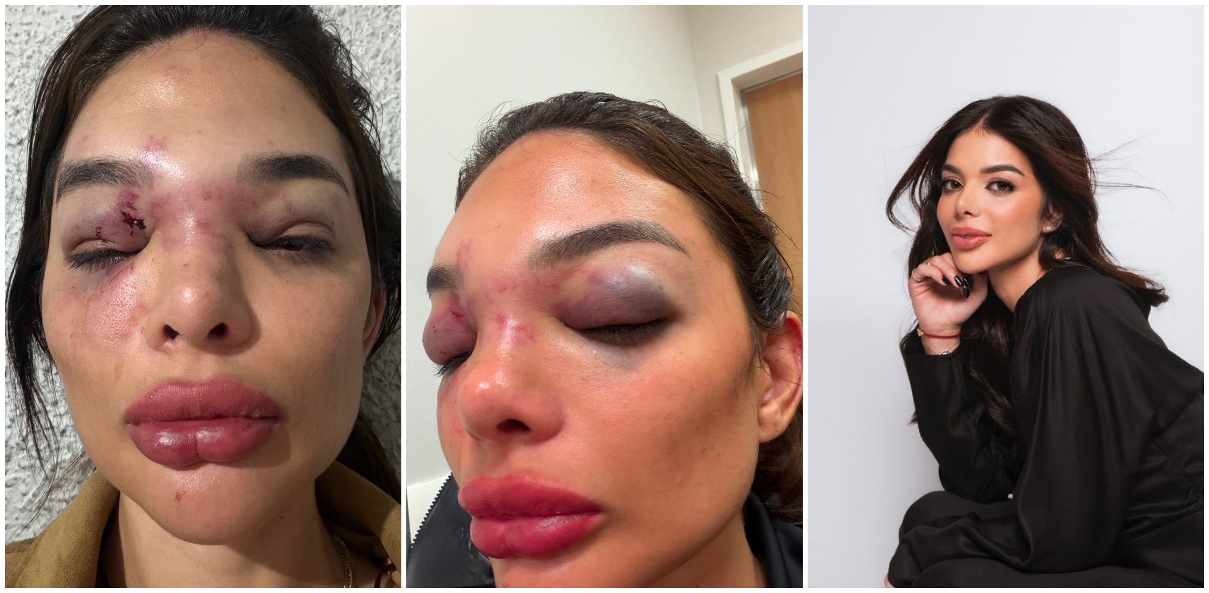 Empresário da Faria Lima é preso por agredir e ameaçar mulher em SP G1