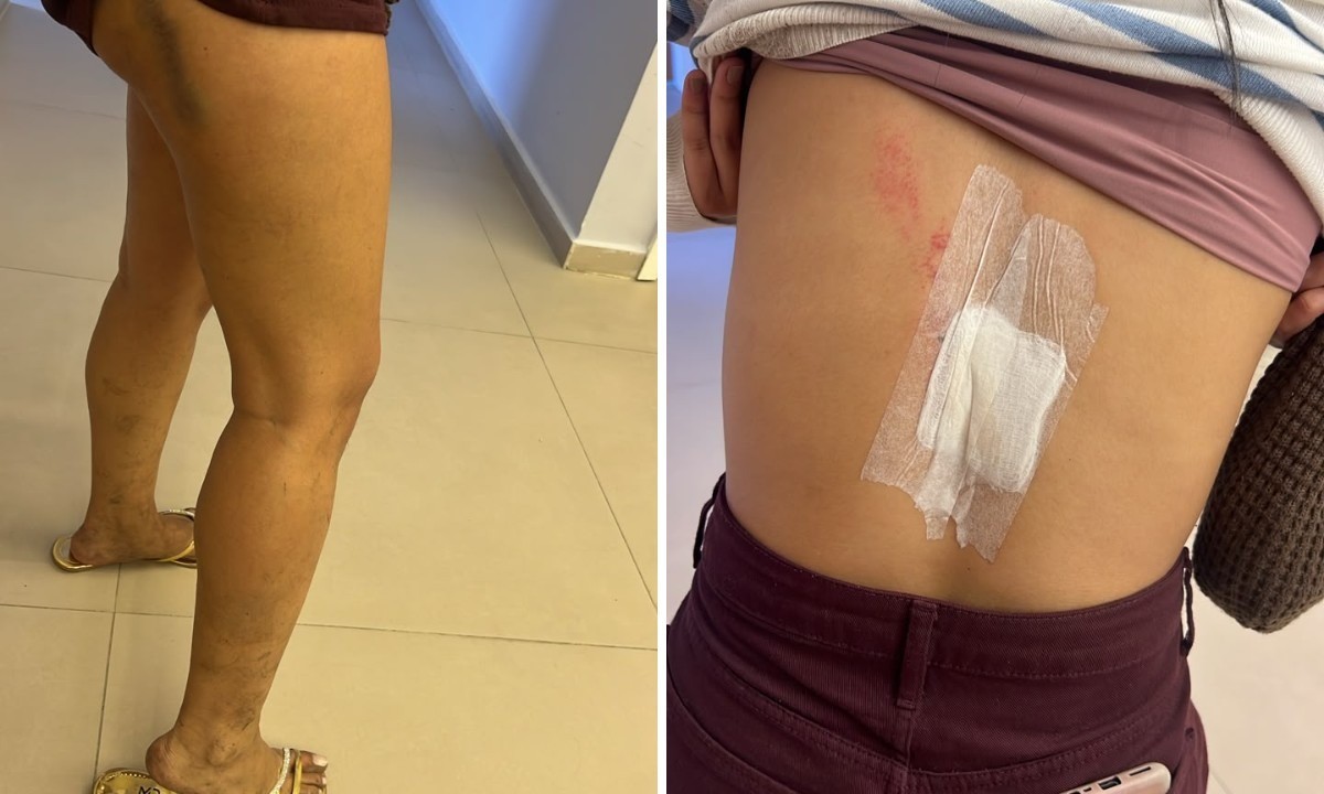 Sobrevivente relata alta velocidade antes de acidente em Petrópolis G1