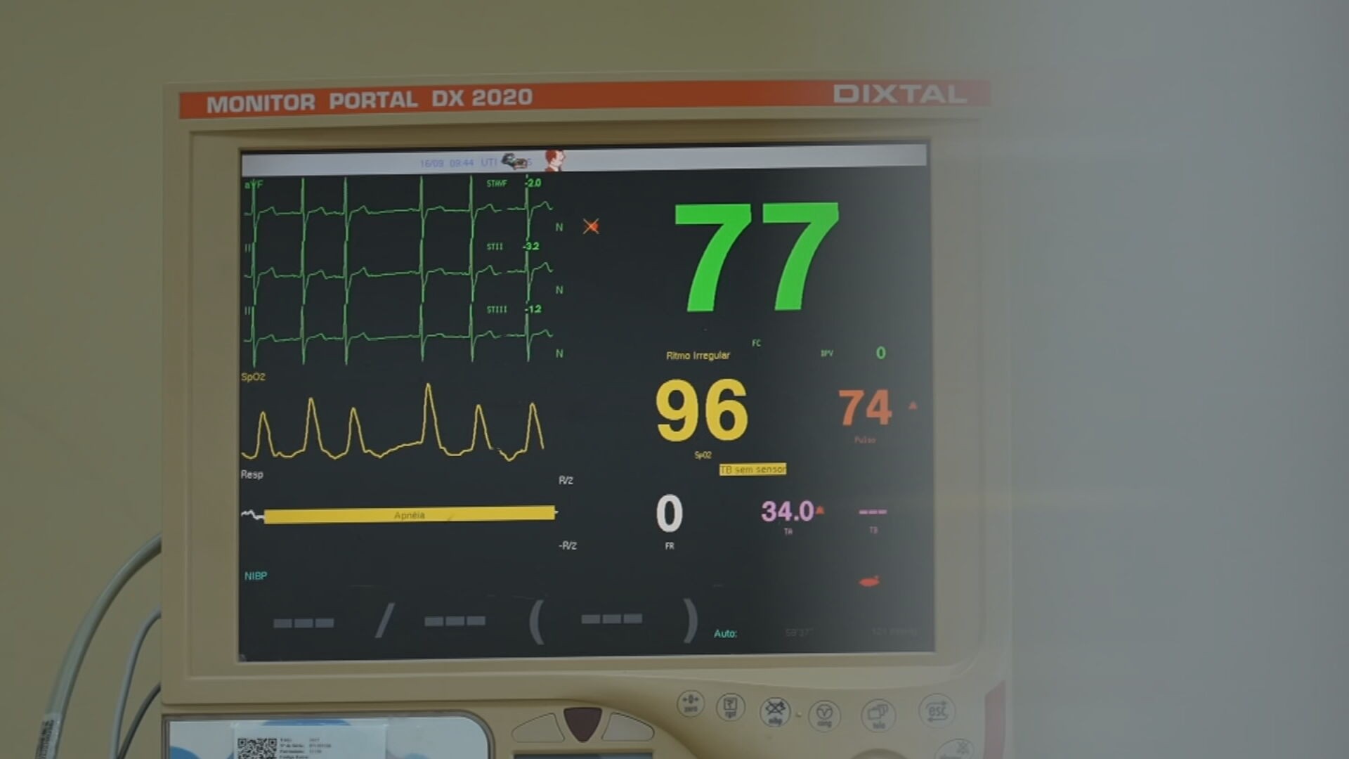 Cardiologia mundial: só exame de sangue alterado não fecha diagnóstico G1