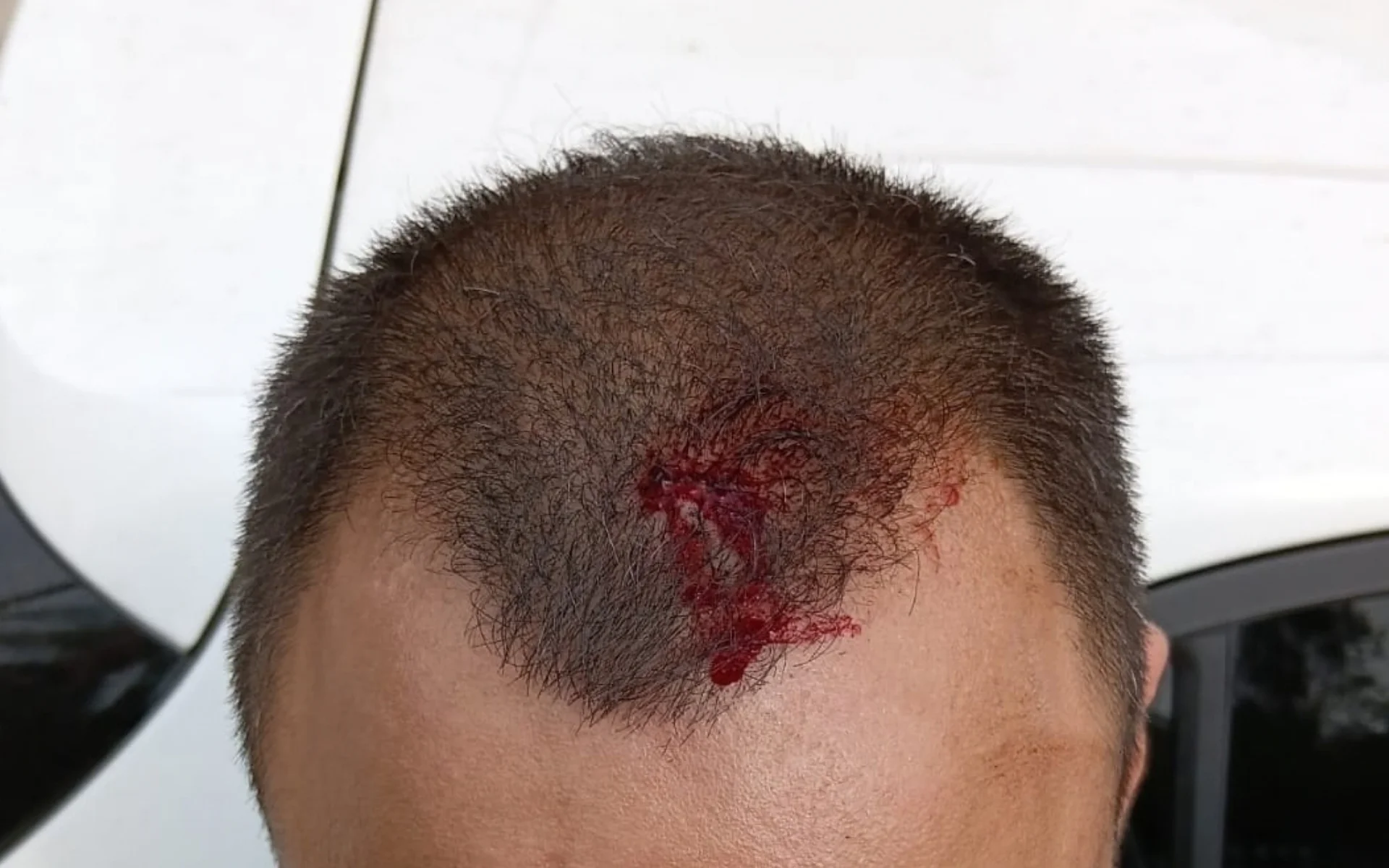 Investigação contra o tráfico termina em confusão entre policiais e moradores em São Leopoldo abc+